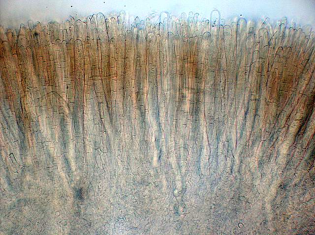 Alla ricerca della spugnola acuminata